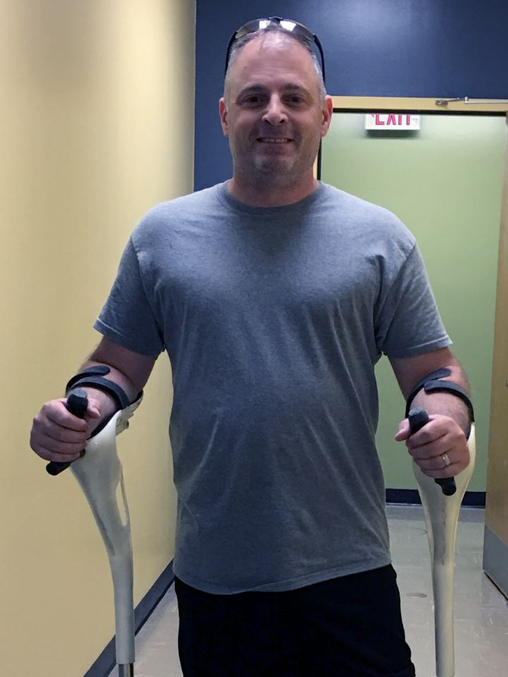 William explains why he feels the M+D Crutch is an advancement in medical technology over a traditional civil war-era crutch